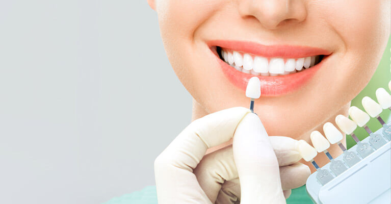 Dental Implants header